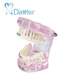Modello Anatomico Dentale Ortodontico in Resina Plastica per Comunicazione Professionale con Pazienti - Product Image 6