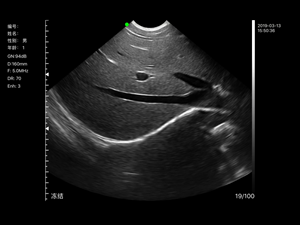 Pemindai Cembung 192 Elemen Nirkabel, Doppler Warna Ultrasound, Mikro Cembung Leher C10RS - Product Image 5