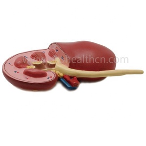 Modelo de Anatomía de riñón de enfermedad educativa médica de humano - Product Image 4