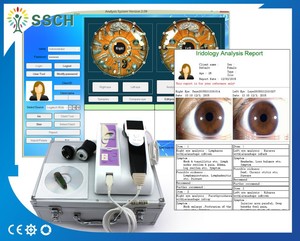 El más caliente! Nueva llegada ojos iriscopio iridología cámara con software GY-9888U - Product Image 1