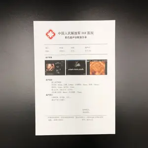 最新设计定制三面板发光二极管查看器超薄发光二极管x射线胶片上市