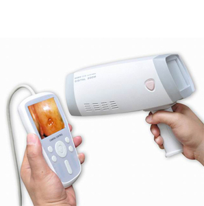YSPL9800B ysen genggam colposkop portabel sistem ginekologi video endoskopi Digital