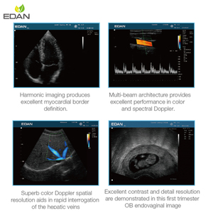 Bon <span class=keywords><strong>prix</strong></span> 12.1 "Machine à ultrasons Doppler couleur EDAN U50 portable pour homme - Product Image 6