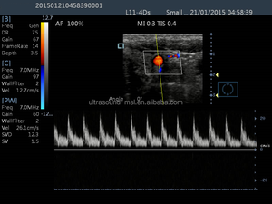 MSLCU25F <span class=keywords><strong>machine</strong></span> à ultrasons doppler Couleur/portable à ultrasons à écran tactile - Product Image 6