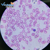 Microscope Prepared Slides Cheap Price Hematology Prepared Slides Blood Smear Microscope Accessories Slide Hematology