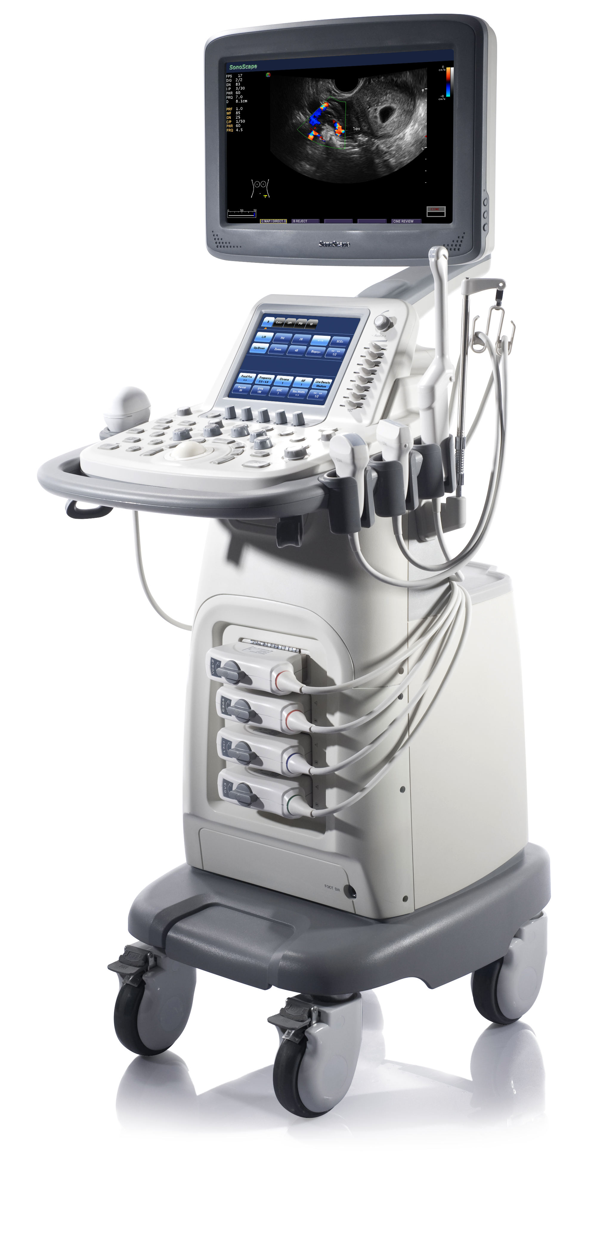 Sonoscape S20 3D 4D 超声机/最佳价格S20 sonoscape 超声机| Alibaba.com