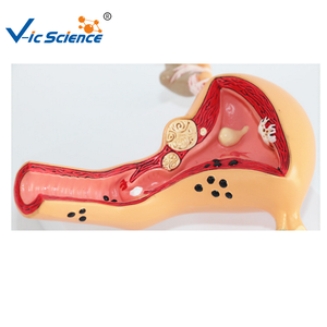 نموذج تشريحي طبي علم طبي للجهاز التناسلي للإناث نموذج تشريحي لنموذج تعليم العلوم الطبية - Product Image 4