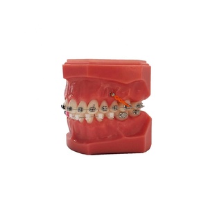 Giá Đỡ Chỉnh Nha Sapphire Tự Điều Chỉnh - Product Image 5