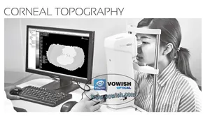 Equipamento topográfico corneal SW-6000 para venda, equipamento corneal topographic