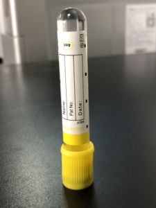 Trung Quốc Nhà Sản Xuất Ce 5Ml Huyết Thanh Phòng Thí Nghiệm Gel Clot Activator <span class=keywords><strong>Edta</strong></span> <span class=keywords><strong>2na</strong></span> Tách Chân Không Bộ Sưu Tập Thử Nghiệm Máu Ống Với Gel - Product Image 6