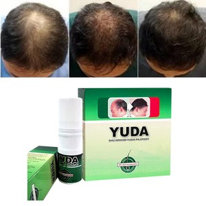 2018 nuevos distribuidores de productos para el crecimiento del cabello Original Yuda Spray para el crecimiento del cabello para engrosar el cabello - Product Image 2