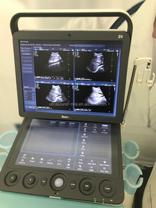 Sonoscape S9 High-End Tangan <span class=keywords><strong>Doppler</strong></span> Berwarna Terjemahan Mindray M7 Mesin Ultrasound - Product Image 3