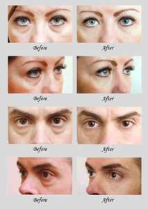 ครีมลดริ้วรอยเพื่อความงามใต้ตาเพื่อการต่อต้านริ้วรอย - Product Image 4