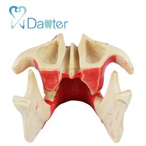 Goede Kwaliteit Ortho Implantaat Praktijk Kaak Model Dental Implant Model