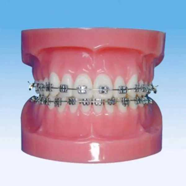 Pvc tıbbi yüksek kalite/sıcak satış ten rengi Chinon Oral simülatörü diş hamuru hastalık patolojik diş modeli