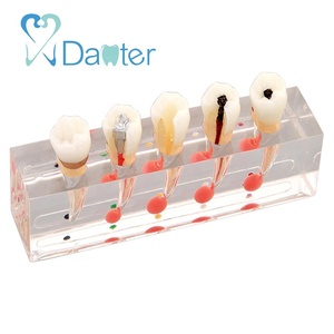 Hoogwaardige Hars Endodontische Behandelingsmodel Voor Het Demonstreren Van <span class=keywords><strong>5</strong></span> Stadia Van Wortelkanaalprocedure Op Tweede Premolaar - Product Image 2