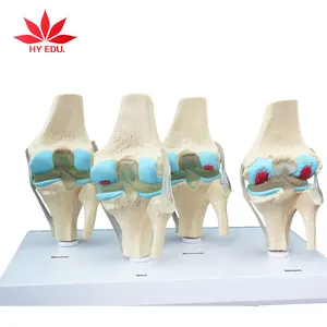 고품질 PVC 공부를 위한 투명한 인간적인 단계 4 무릎 합동 모형