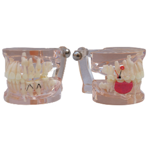 Gelsonlab HSDT-C8 Mixte Clair avec dents manquantes modèle de Dents Dentaires Pathologie Modèle D'étude Démonstration Modèle D'enseignement - Product Image 1