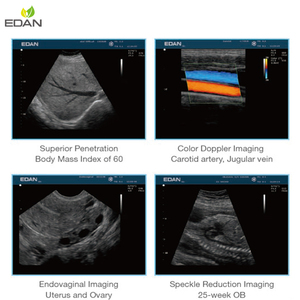 Troli USG <span class=keywords><strong>Edan</strong></span> U2 dengan 4 Konektor Transduser Sistem USG Doppler Warna Aktif - Product Image 5