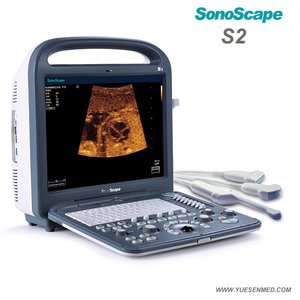 Ecógrafo Veterinario Doppler Color <span class=keywords><strong>4D</strong></span> Sonoscape S2V, Equipo de Ultrasonido Veterinario, Escáner de Ultrasonido Portátil Veterinario - Product Image 4