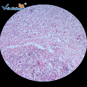 Lames préparées pour microscope 200 pièces diapositives éducatives lames de microscope de pathologie humaine ensemble de pathologie scientifique médicale - Product Image 6