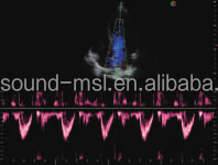 Hoge Gevoelige Levendig Beeld Trolly Kleur Doppler Echografie Sonoscape S20 Met Probes En Tranducers - Product Image 6