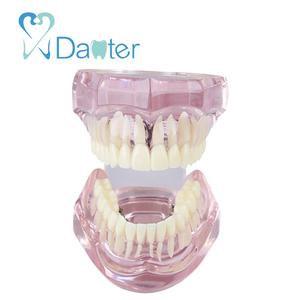 Prezzo di fabbrica Dentale Ortodontico Modello con Staffa Linguale per Dentale Studente Pratica