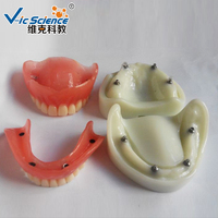 Modelo de Dientes Humanos, Modelo de Implante de Dentadura Completa, Modelo Educativo de Ciencias Médicas