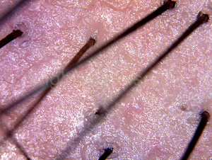 CE FCC ROHS Usb <span class=keywords><strong>microscopio</strong></span> Digital de la piel para la piel de inspección - Product Image 5