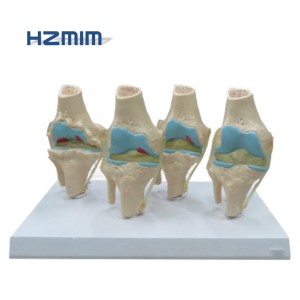 Modèle de genou pour l'arthrite, modèle des articulations du genou à 4 étages - Product Image 4