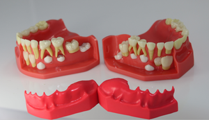 Mezcla de dentición pediátrica modelo de desarrollo edad 5-9 - Product Image 2