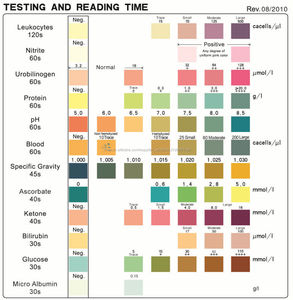 Diagnostic médical d'<span class=keywords><strong>urine</strong></span> microalbumine <span class=keywords><strong>test</strong></span> kit <span class=keywords><strong>12</strong></span> paramètres bandes d'<span class=keywords><strong>urine</strong></span> URS-12MA - Product Image 3