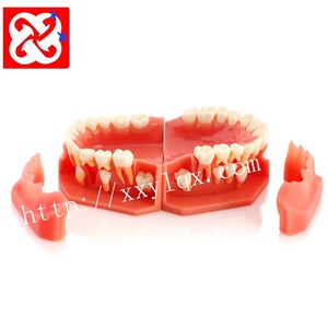 Mixed Dentition Pediatric Development Model for Demonstration at <strong>Age</strong> 9-12 - Product Image 1