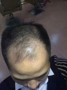 OEM China Professionelle Lieferanten Design Entspannt Linie Groß Haar Wachstum Produkt Natürliche Haarpflege Produkt Private Label haarpflege - Product Image 5