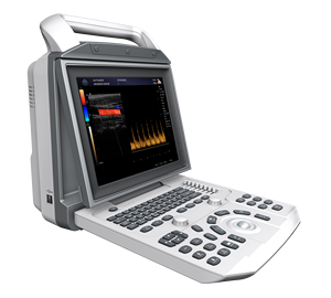 휴대용 심장 초음파 기계 컬러 도플러 초음파 기계 MSLCU45