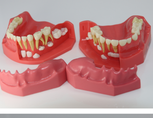 Mezcla de dentición pediátrica modelo de desarrollo edad 5-9 - Product Image 1