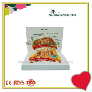 Modelo Anatômico de Doença de Lesão em Patologia Mamária - Product Image 2