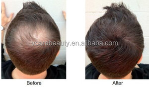 1kg Embalagem personalizada Tratamento Do Cabelo Remover Careca Recargas & engrossa o cabelo para a fibra do cabelo recheio - Product Image 3