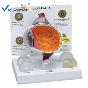 Globo ocular humano catarata anatomia modelo olho humano anatomia modelo medicina ciência escola corpo humano anatômico educação modelo - Product Image 1