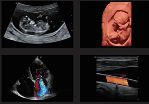 Nieuwe Sonoscape P50 P20 kleur doppler echografie machine met diagnostische 4D technologie - Product Image 6