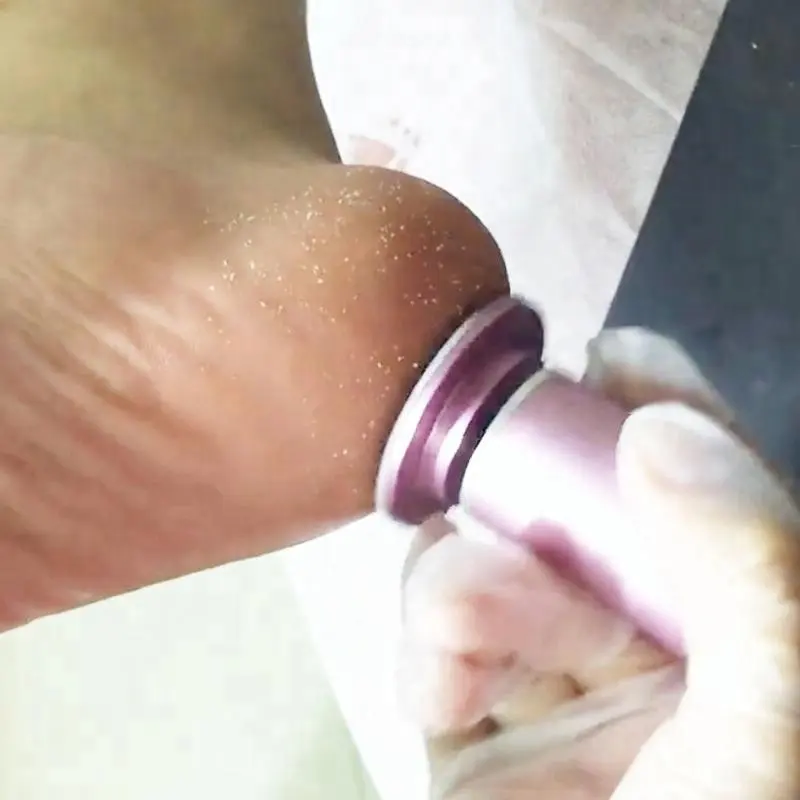 Pedicura pie raspador de pedicura eléctrico removedor de callos para callos pies