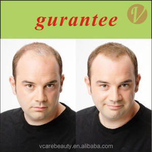 ที่มีคุณภาพสูงขายส่งธรรมชาติผ้าฝ้ายอินทรีย์เคราตินโปรตีนสีผงกลุ่มเติม Keralux <span class=keywords><strong>ผม</strong></span>ไฟเบอร์อาคารไมโครไฟเบอร์ - Product Image 2