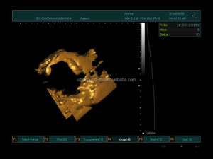 Máquina de ultrasonido portátil MSLPU34, precio, ecocardiografía médica, USD Echo - Product Image 6