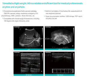 เครื่องอัลตราซาวด์สีแบบพกพา <span class=keywords><strong>Sonoscape</strong></span> A6 พร้อมใบรับรองระดับสากล - Product Image 4