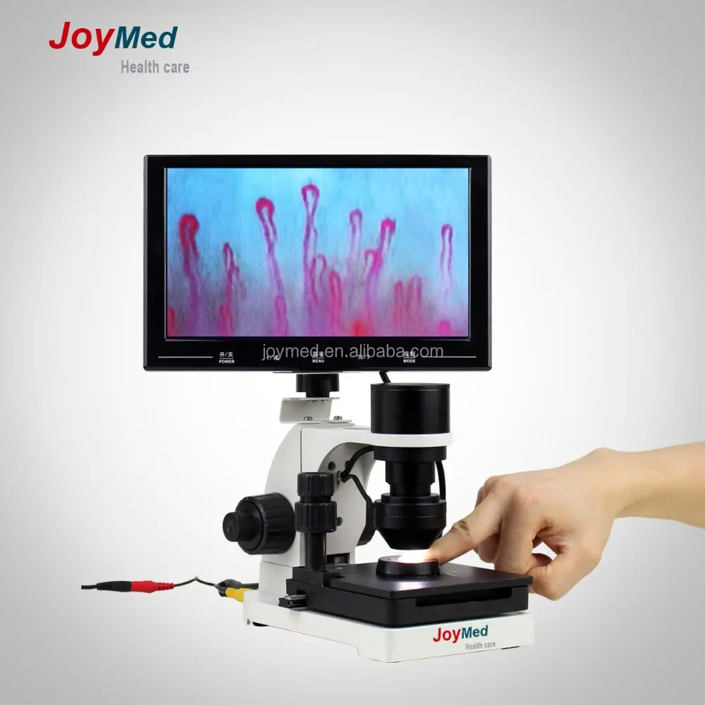 JOYMED Noninvasive blut kapillare mikrozirkulation mikroskop, capillaroscope, Subhealth detektor