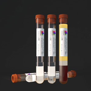 Dr Gebruik Lab ACD-A Gel Vitamine Bloedplaatjesrijke Plasma Prp Kit Haar Set Medische Benodigdheden - Product Image 5
