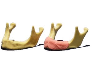 Gesimuleerd trainingsmodel voor mandibulaire implantaten - Product Image 1