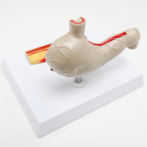 Gelsonlab HSBM-272 qualité Avancée Malades <span class=keywords><strong>L</strong></span>'<span class=keywords><strong>estomac</strong></span> modèle d'<span class=keywords><strong>estomac</strong></span> Médical modèle - Product Image 4