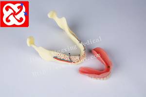 Gigi Tiruan Implan dan Pemulihan Anatomi Rahang Model - Product Image 6