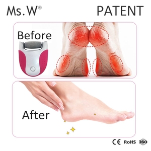 Ms. W mejor venta <span class=keywords><strong>de</strong></span> productos <span class=keywords><strong>de</strong></span> belleza y cuidado <span class=keywords><strong>de</strong></span> los <span class=keywords><strong>pies</strong></span> personal eléctrico mini <span class=keywords><strong>lima</strong></span> <span class=keywords><strong>de</strong></span> uñas mejor removedor <span class=keywords><strong>de</strong></span> callos - Product Image 6